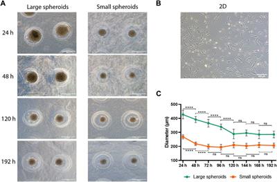 Spheroid size influences cellular senescence and - Frontiers